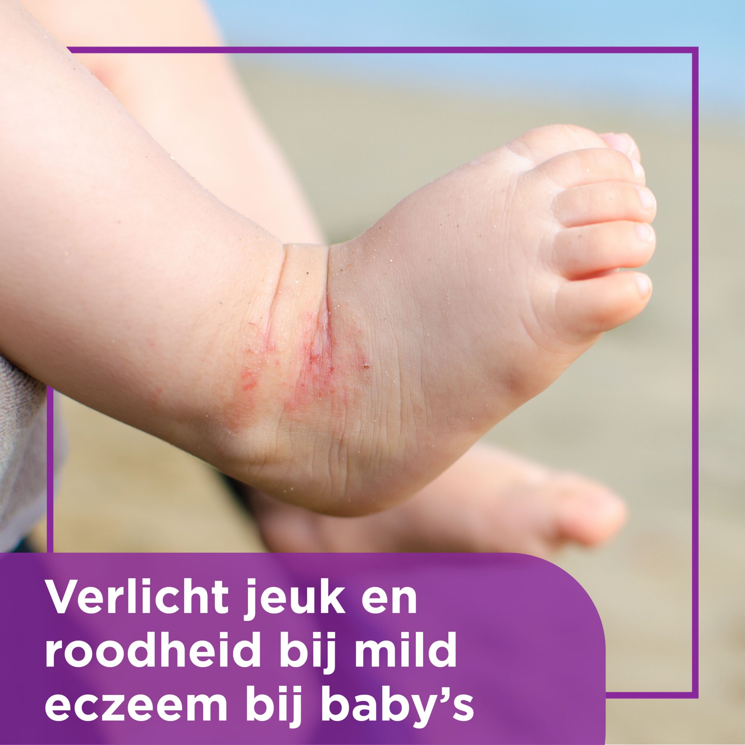 Bepanthen Eczeem baby creme - Afbeelding 5